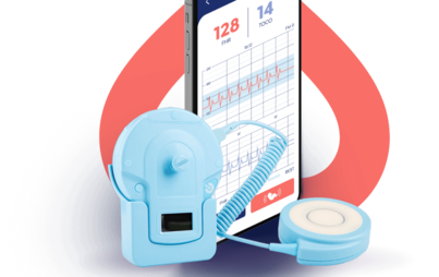 Zdjęcie do Pilotażowy projekt &bdquo;teleKTG&rdquo; dla kobiet w ciąży